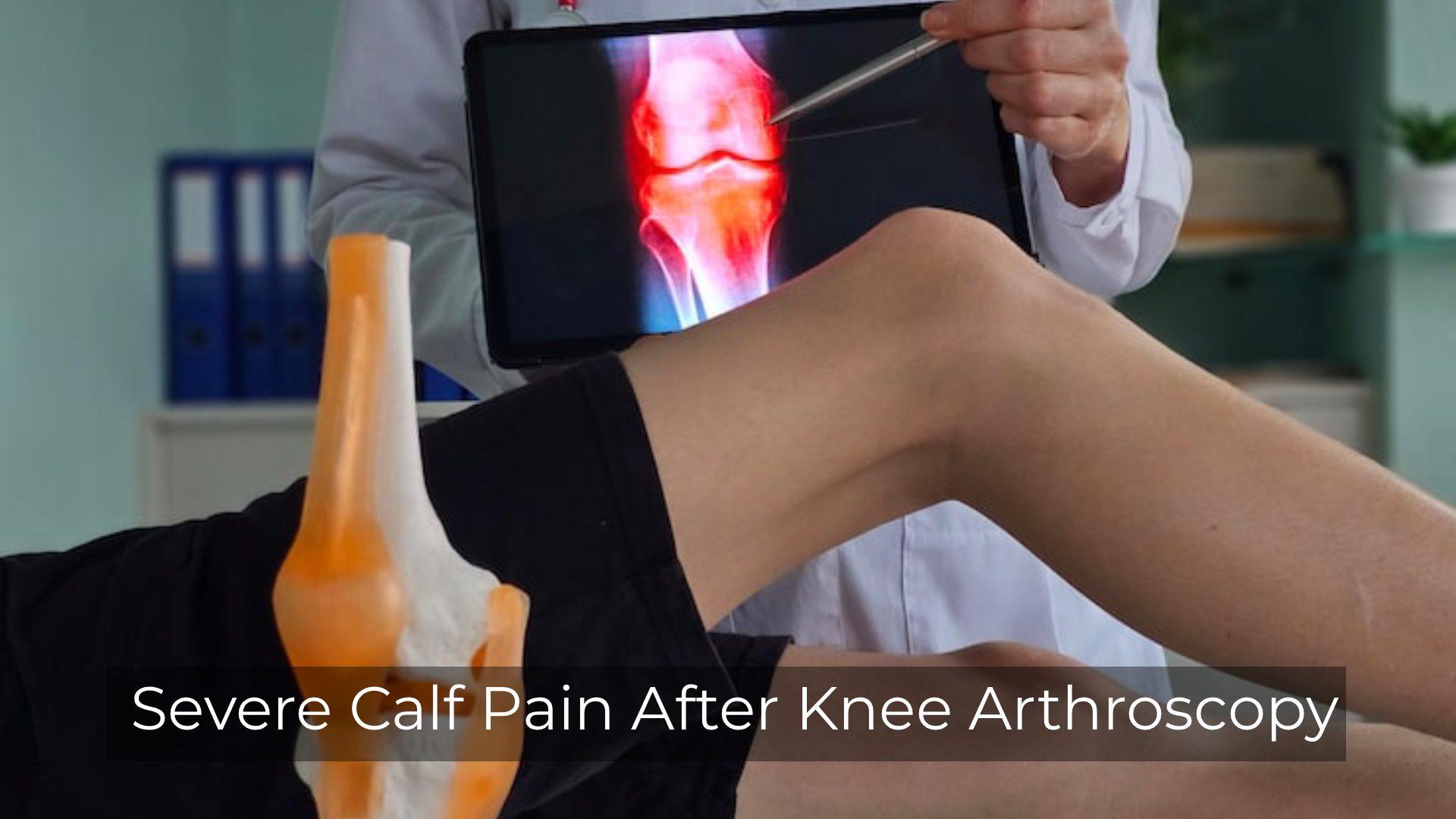Severe Calf Pain After Knee Arthroscopy: What To Do
