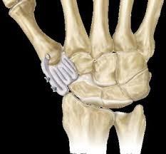 Wrist Arthroscopy TFCC Repair: Complete Recovery Guide