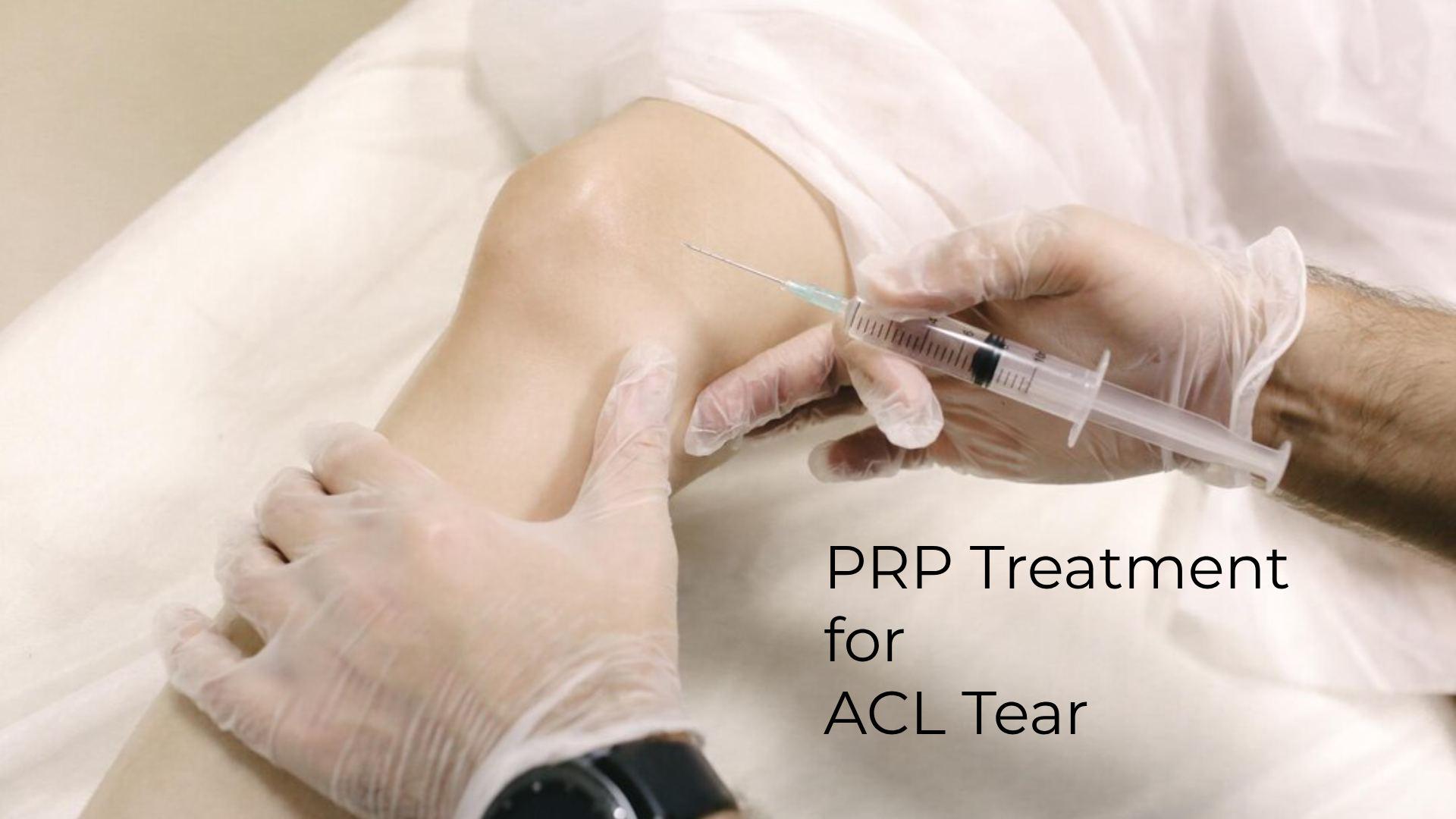 PRP Treatment for ACL Tear: Recovery & Healing Guide