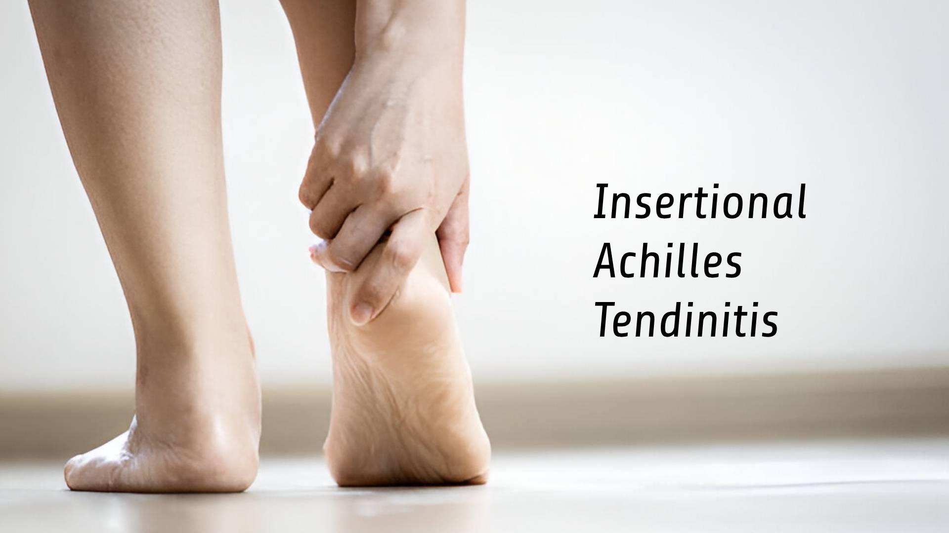 Insertional Achilles Tendinitis: Causes, Symptoms, and Cure