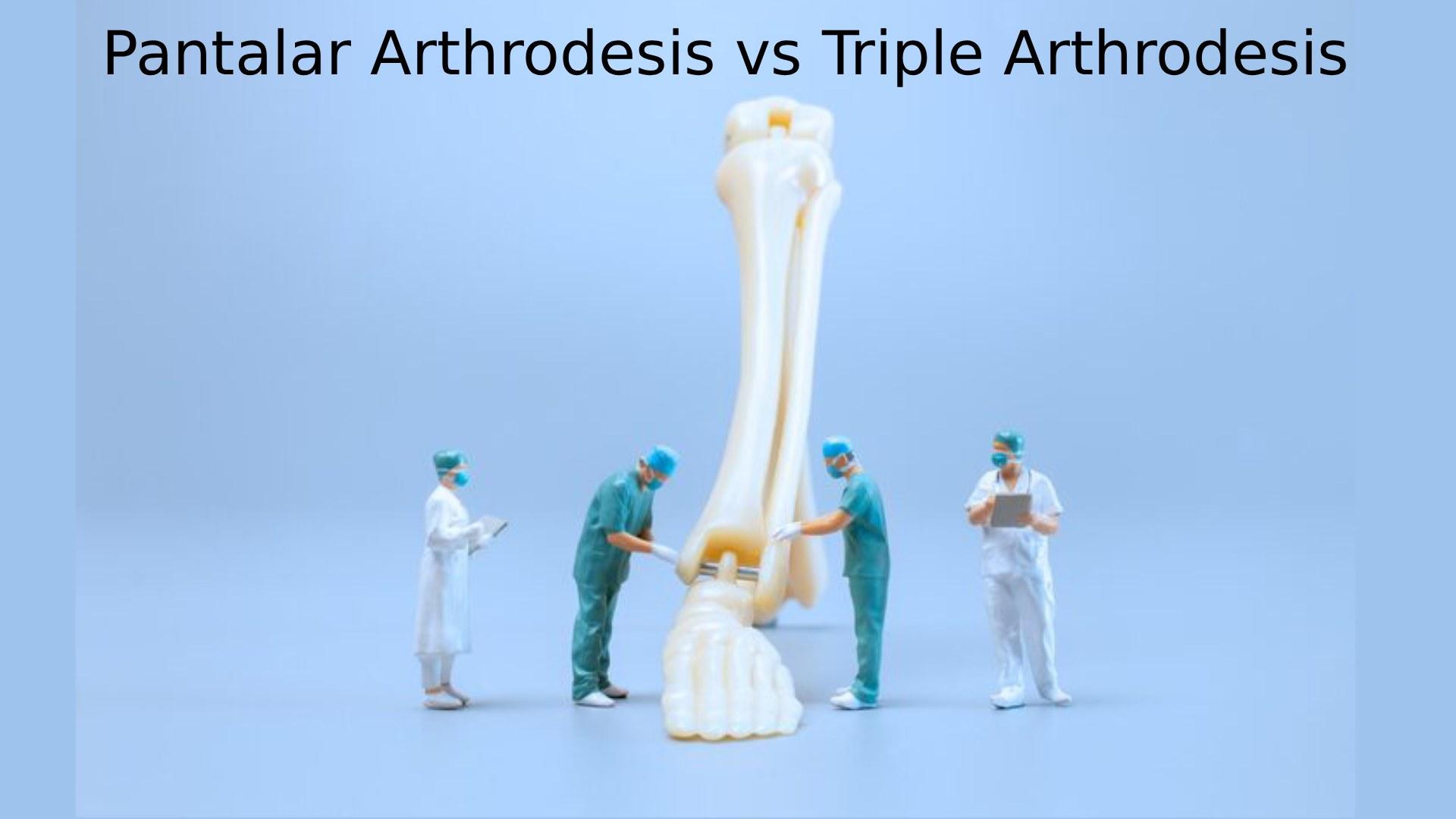 Pantalar Arthrodesis vs Triple Arthrodesis: Complete Surgical Guide