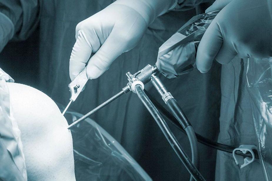 Arthroscopic Debridement Guide: Procedure and Recovery