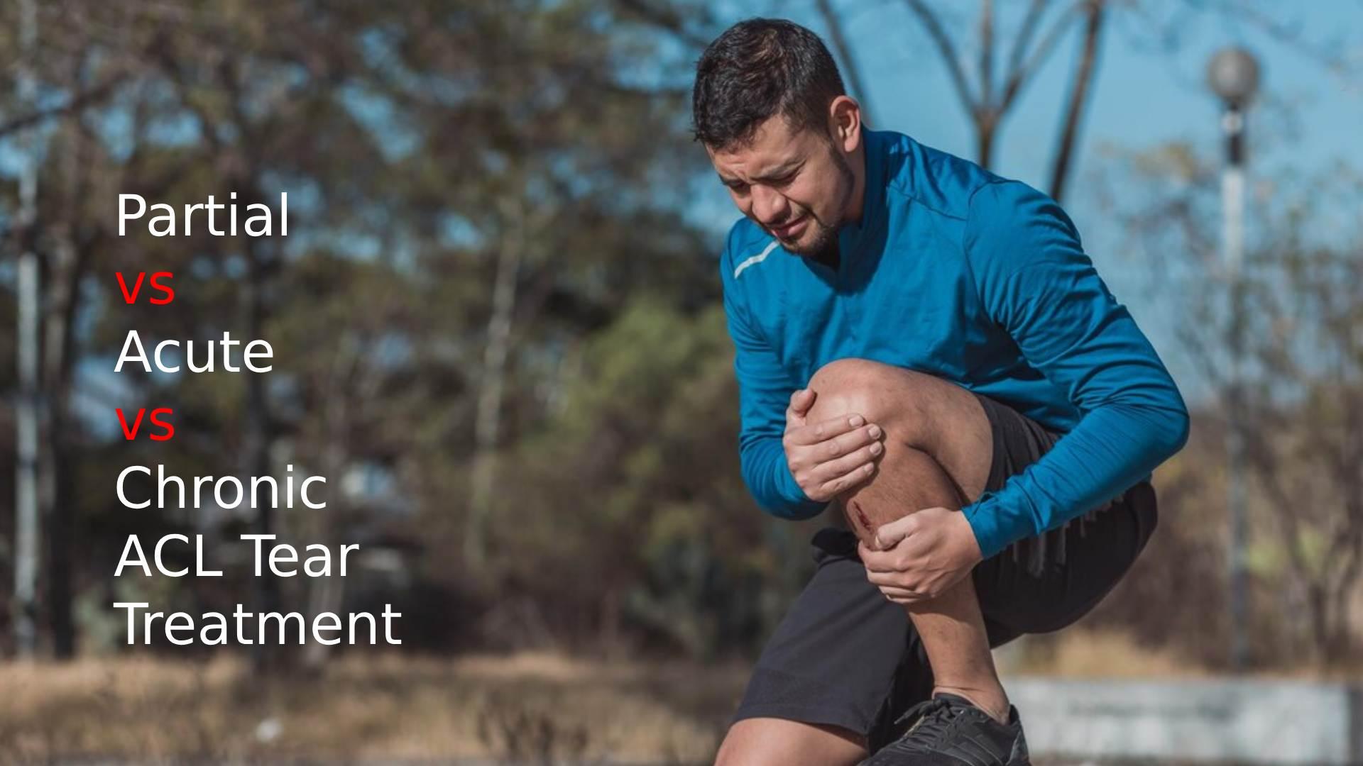 Partial vs Acute vs Chronic ACL Tear Treatment Explained