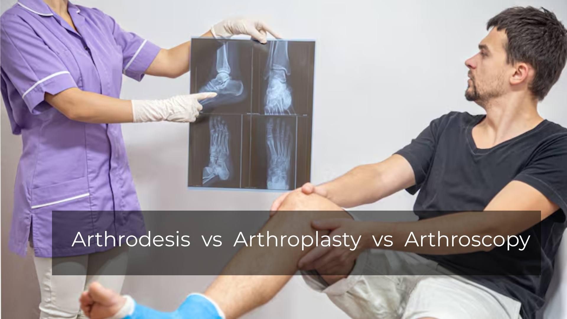 Arthrodesis vs Arthroplasty vs Arthroscopy: Joint Care Guide