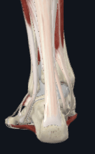 Achilles Tendon Tear