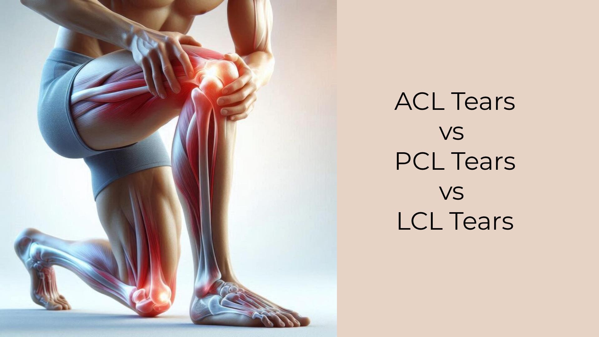 ACL vs PCL vs LCL Tears: Causes, Symptoms & Recovery Guide