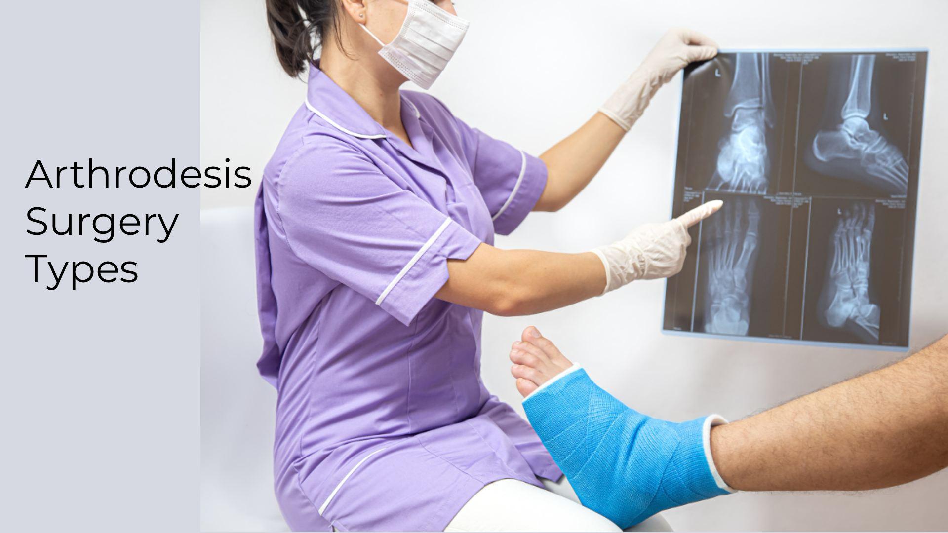 Arthrodesis Surgery Types & Options: Full Guide for 2025