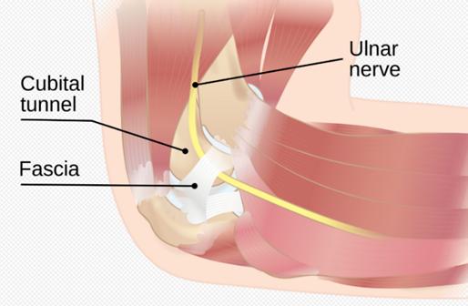 Cubital Tunnel Syndrome Treatment