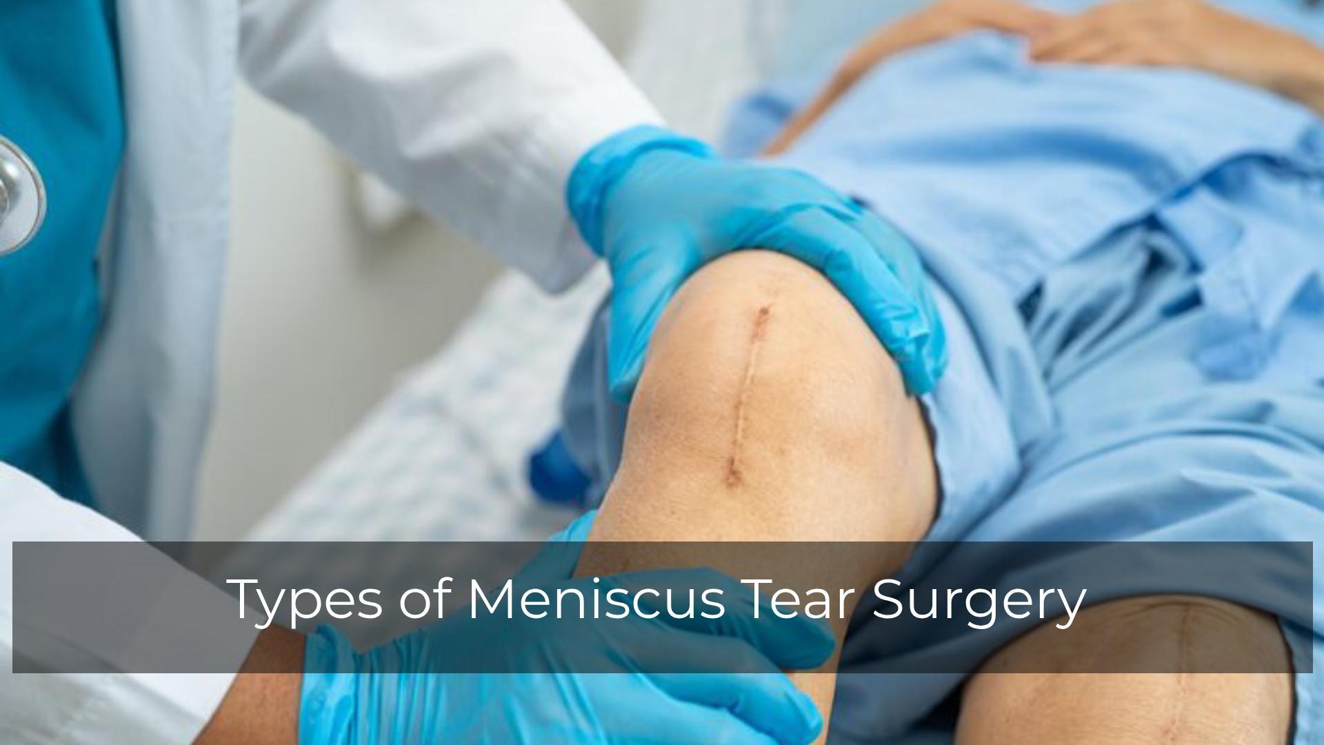 Types of Meniscus Tear Surgery: Choosing the Right Treatment