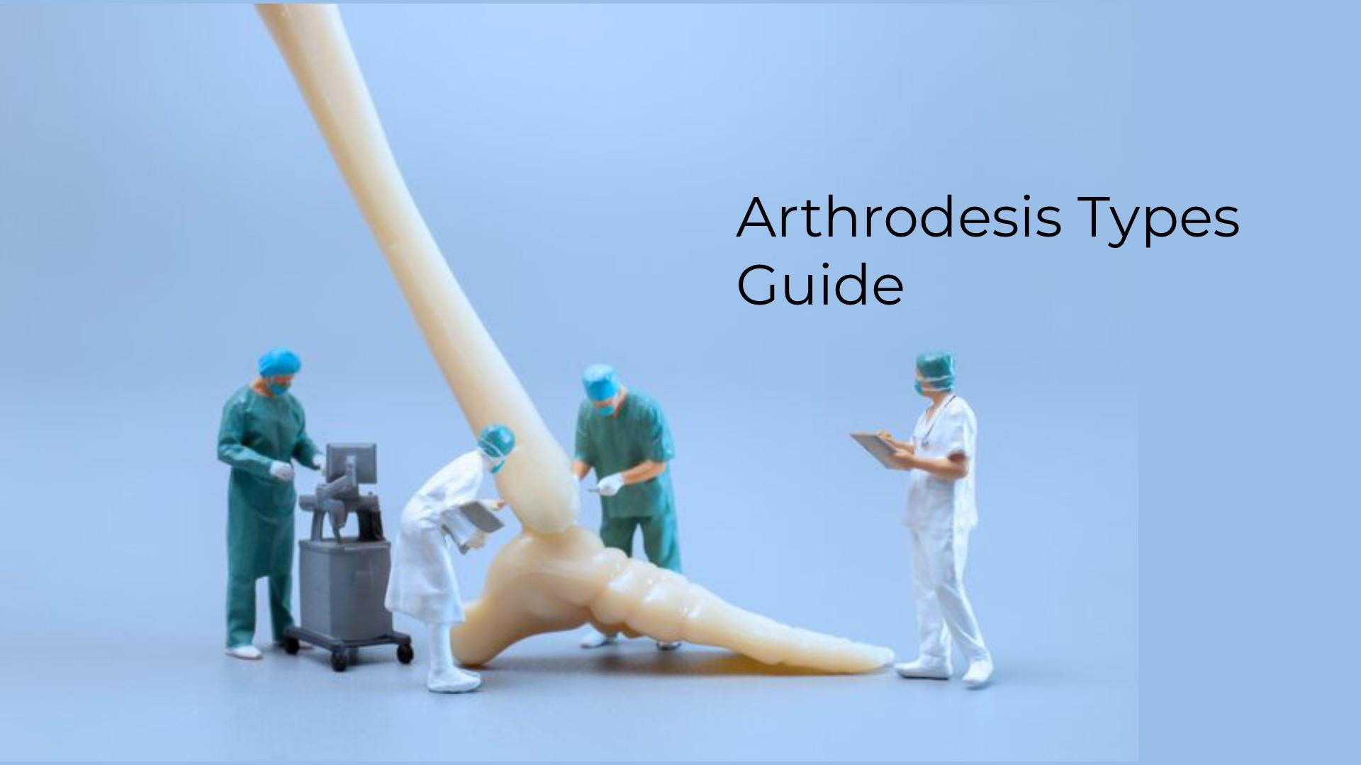 Arthrodesis Types Explained: Joint Fusion Surgery Guide
