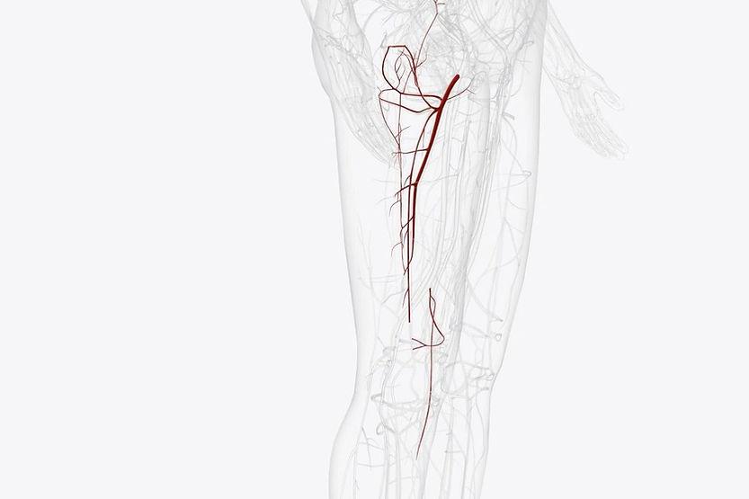 Stages of Avascular Necrosis: Symptoms and Treatments