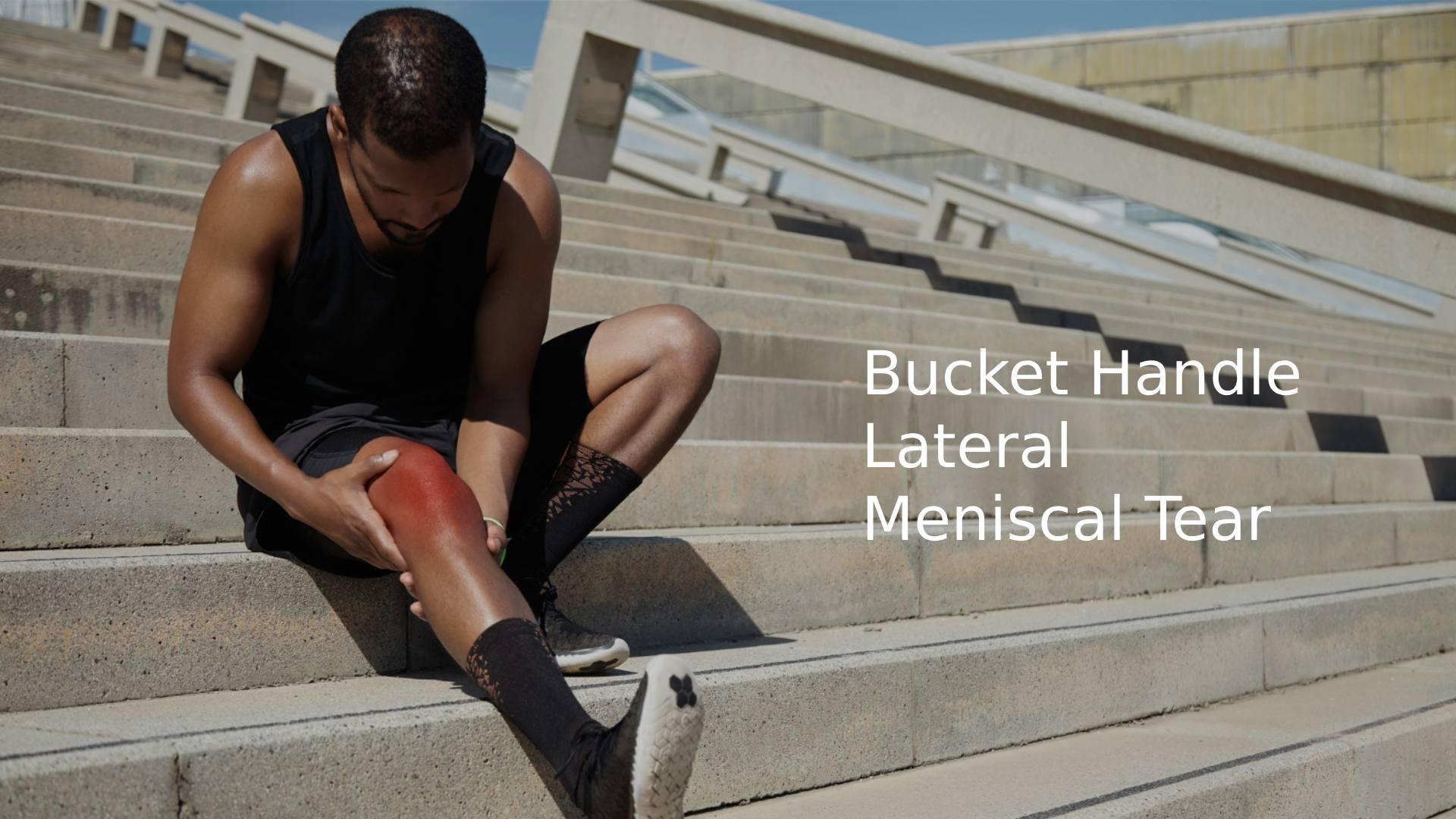 Bucket Handle Lateral Meniscal Tear: Complete Treatment Guide