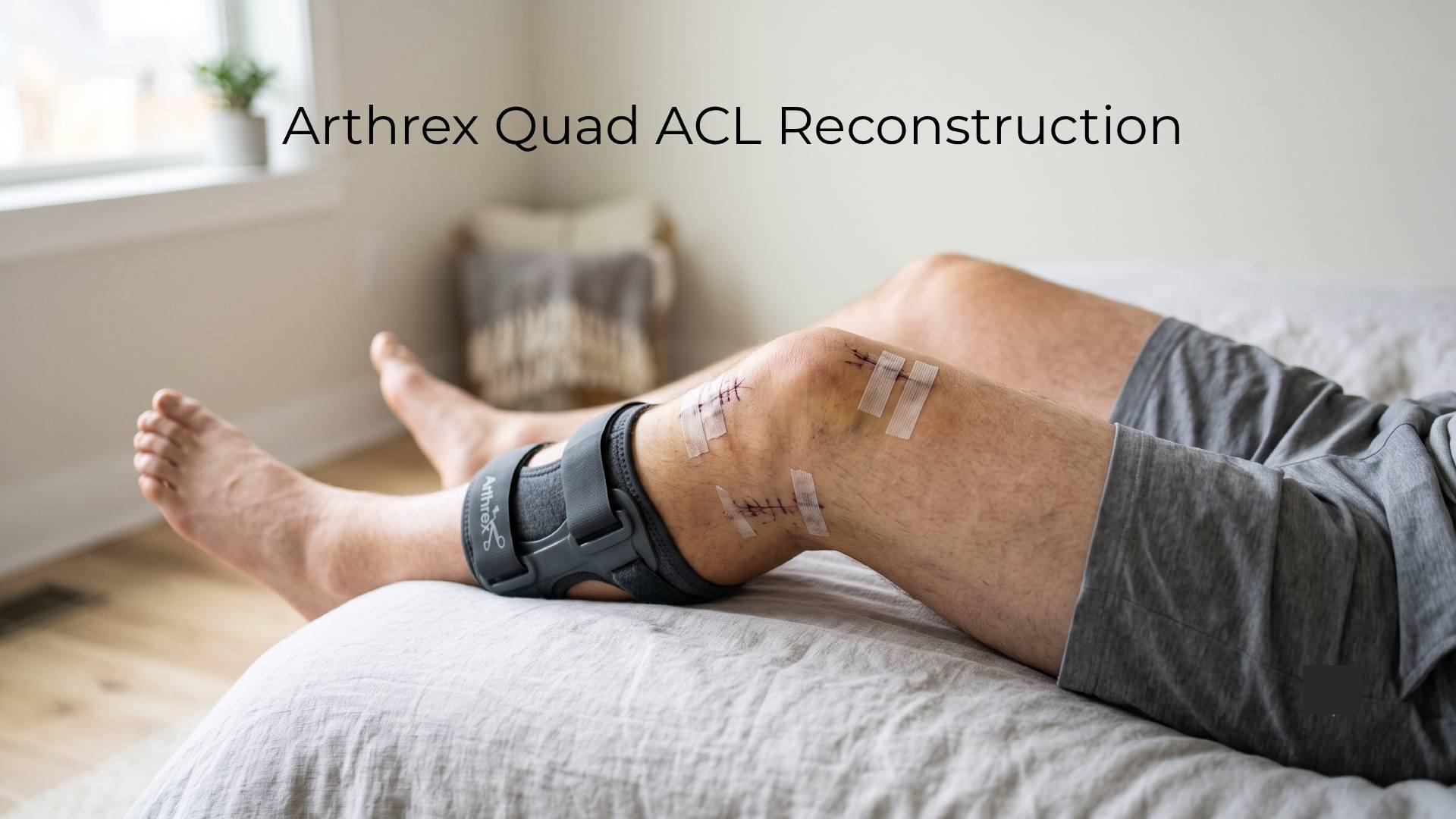 Arthrex Quad ACL Reconstruction: Technique and Recovery