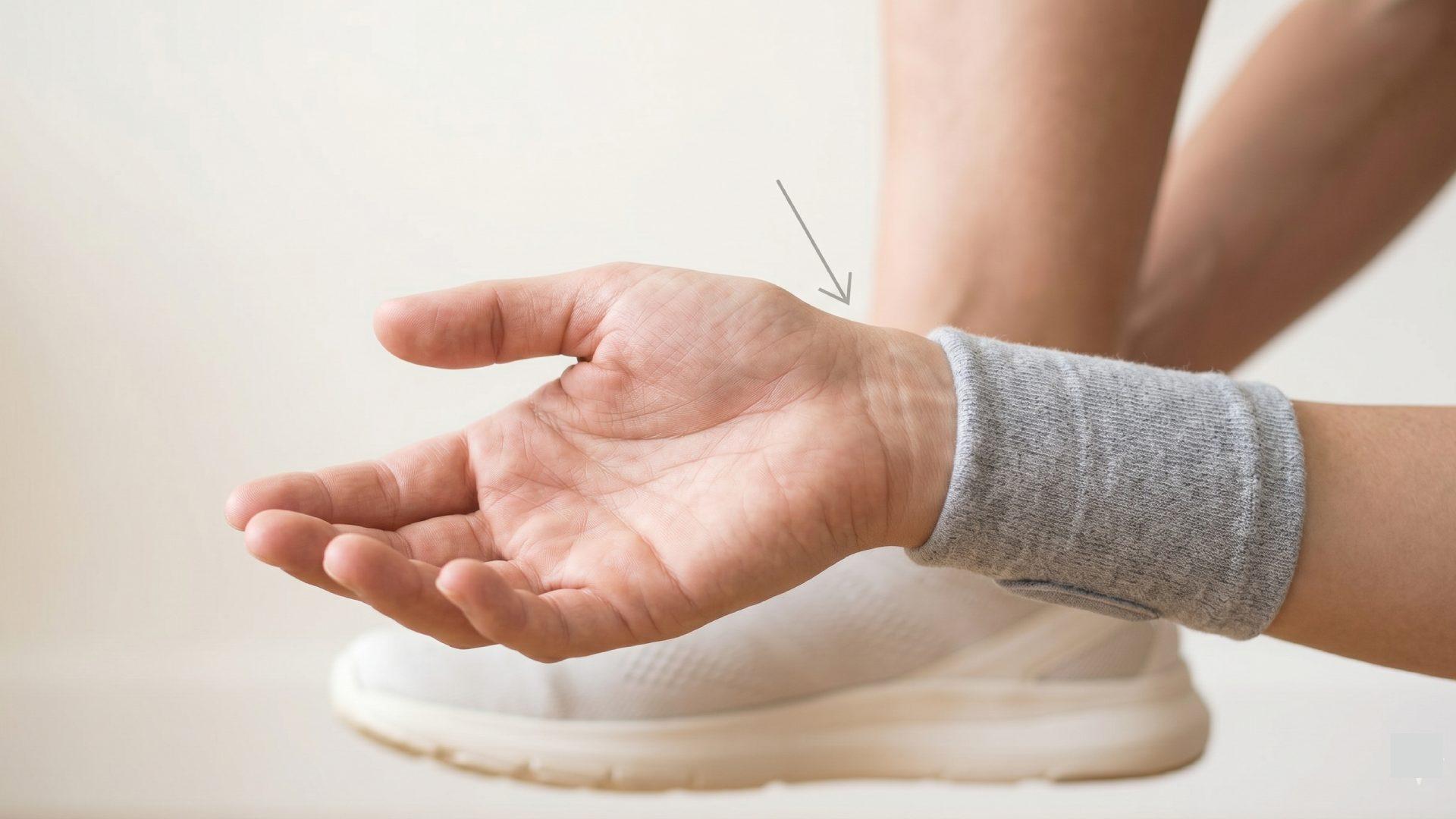 Carpal Tunnel Syndrome