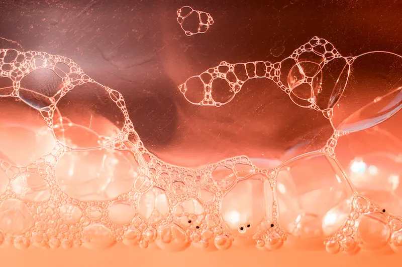 Stem Cell Therapy – A Permanent Cure For Avascular Necrosis Of Hips