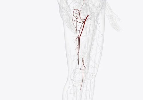 Stages of Avascular Necrosis: Symptoms and Treatments