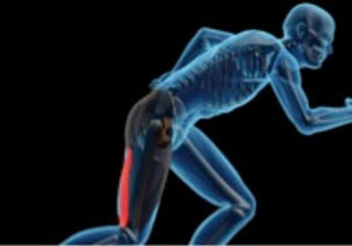 Hamstring Strain